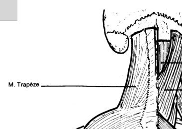 Septum nuchal arrière